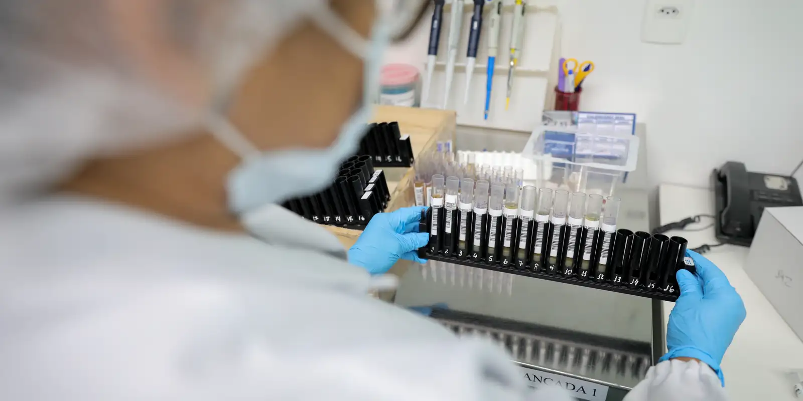 Anvisa autoriza teste em humanos de vacina 100% brasileira